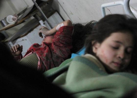 Injured girls lie in a field hospital, after what activists said was an airstrike by forces loyal to Syria's President Bashar al-Assad, in the Duma neighborhood of Damascus, February 3, 2015. REUTERS/ Mohammed Badra