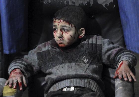 A wounded boy sits at a field hospital after what activists said was an air strike by forces of Syria's President Bashar al-Assad in the Duma neighborhood of Damascus, February 2, 2015. REUTERS/Mohammed Badra