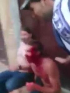 Terrified-tourists-are-left-covered-in-blood-after-two-men-hack-at-them-with-knives-in-random-attack-